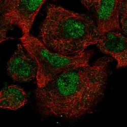CARD8 Antibody, Novus Biologicals 0.1mL; Unlabeled:Antibodies, Polyclonal